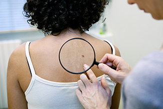 Skin Cancer Warning Signs